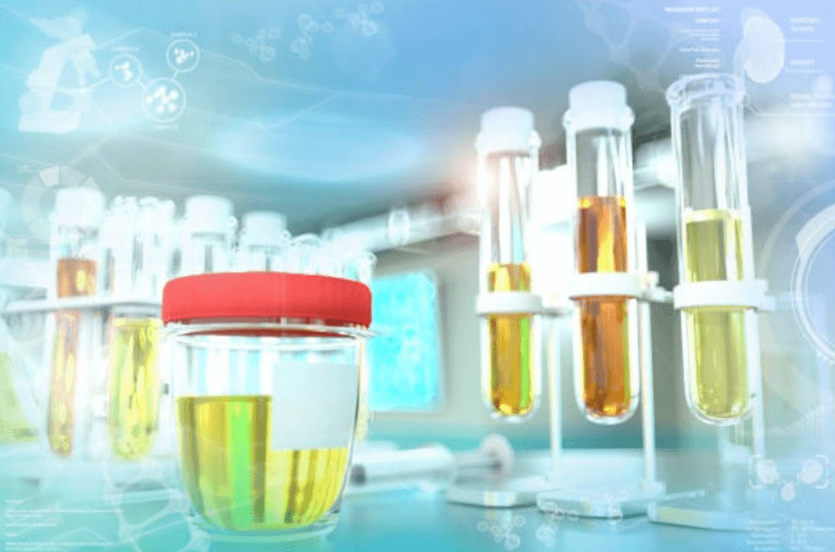 Hematuria