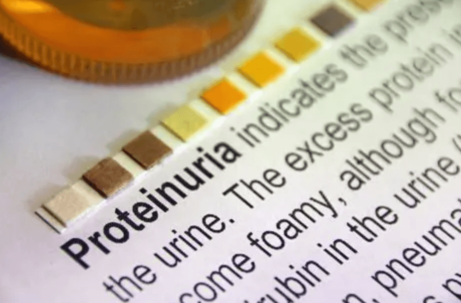 Proteinuria