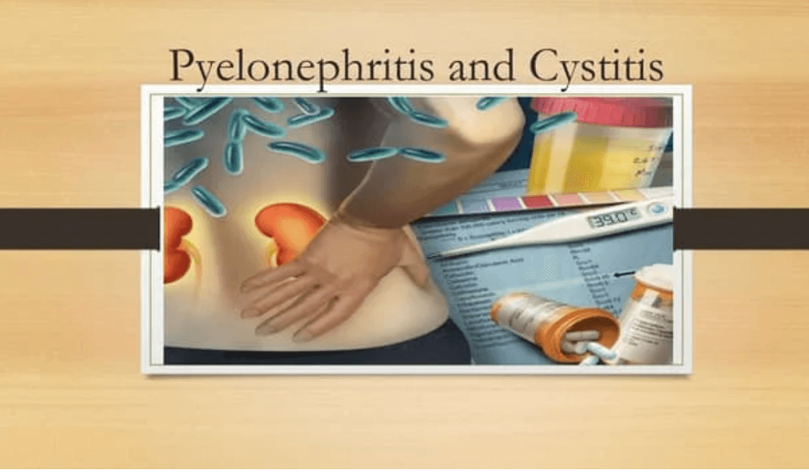 UTI / Pyelonephritis
